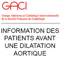Apercu consentement Dilatation aortique